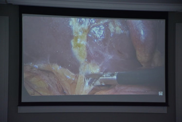Şamaxıda Azərbaycan Minimal İnvaziv Cərrahlar Cəmiyyətinin 12-ci Regional Konfrans keçirilib