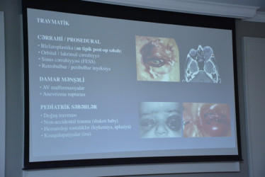 Şamaxıda Azərbaycan Minimal İnvaziv Cərrahlar Cəmiyyətinin 12-ci Regional Konfrans keçirilib